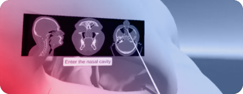 Advanced Surgical Simulation focused on Endonasal Surgeries